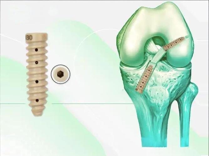 A detailed 3D illustration of a dental implant with a screw, measuring tools, and a healthy tooth.